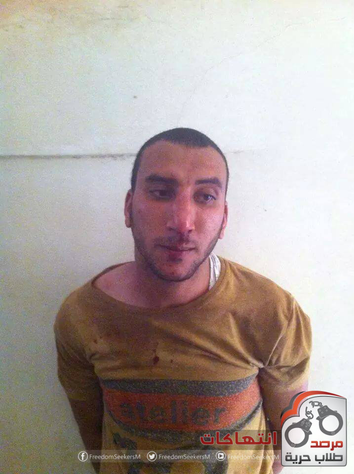 صورة الطالب بعد تعرضه للتعذيب